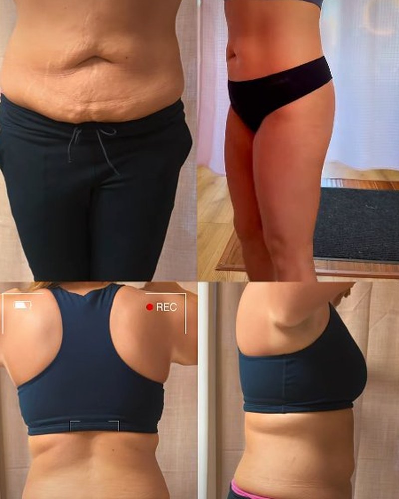 Body sculpting torso before and after — package of 10